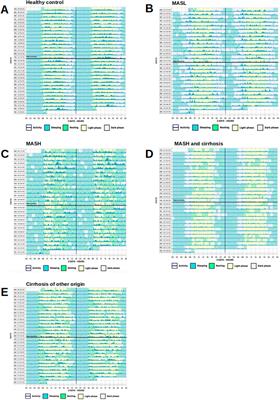 Significant nocturnal wakefulness after sleep onset in metabolic dysfunction–associated steatotic liver disease